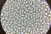 Baking_yeast_cells_under_40x_microscope_objective