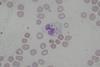 Pseudomonas_aeruginosa_smear_MGG_2010-02-10