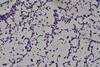 Staphylococcus_aureus_Gram_stain (2)