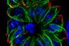 Humans_fibroblasts_infected_with_a_mutant_of_the_intracellular_parasite_Toxoplasma_gondii_-_image.pbio.v10.i12.g001