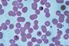 Malaria_falciparum_ring_forms