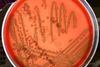 Bacillus_licheniformis_02