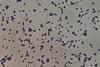 Leuconostoc_mesenteroides_Gram_Staining