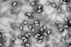 Phage_de_S_aureus_3A