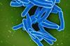 Mycobacterium_Tuberculosis_Bacteria,_the_Cause_of_TB_(52766648935)