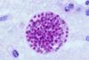 Toxoplasma_gondii_tissue_cyst_in_mouse_brain