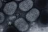 Molluscum_contagiousum_virus_(negative_staining)