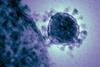 Middle_East_respiratory_syndrome-related_coronavirus