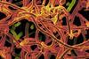 Ebola_Virus_From_Mali_Blood_Sample_(16465524896)
