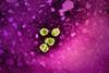 Hepatitis_B_Virus_(52451626575)