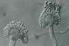 Aspergillus_parasiticus_UAMH5727a