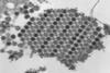 960px-Chikungunya_virus_particles-PHIL-17369