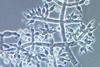 Trichoderma_harzianum