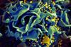 HIV-infected_T_cell_(6813489183)