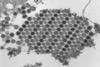 Chikungunya_virus_particles-PHIL-17369 (2)