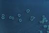 Salmonella_enterica_serovar_typhimurium_01
