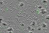Low-Res_Mycobacterium tuberculosis (green) inside human immune cells known as macrophages