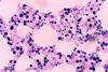 Candida_albicans_(248_35)