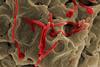 Ebola_Virus_(3)