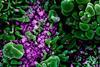 Novel_Coronavirus_SARS-CoV-2_(49666286236)