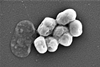 A.baumannii_visualized_using_Scanning_electron_microscopy