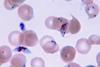 Plasmodium