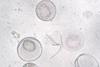 Coscinodiscus_granii