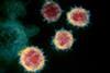 Novel_Coronavirus_SARS-CoV-2