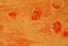 Haemophilus_influenzae_Gram