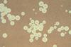 Cryptococcus_neoformans_using_a_light_India_ink_staining_preparation_PHIL_3771_lores (1)