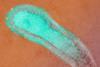 Human_Respiratory_Syncytial_Virus_(RSV)_(52453014952)