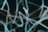 Streptomyces_griseus_color_enhanced_scanning_electron_micrograph.