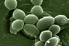 Enterococcus_faecalis_SEM_01_Detail