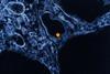 West_Nile_Virus_-_53865578133