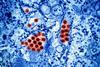 Dengue_Virus_Particles_(53232295844) (1)