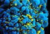 HIV-infected_T_cell_(6813384933)