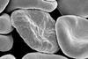 Red_blood_cells_infected_with_malaria