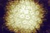 Varicella-zoster_Virus_(5614251360)