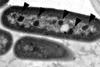 Alpha_and_beta_carboxysomes-B