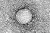 HCV_EM_picture_2