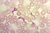 T._cruzi_trypomastigotes_in_peripheral_blood_smear