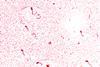 Vibrio_cholerae_01