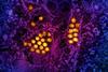 Dengue_Virus_Particles_(53231044882)