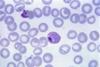 Plasmodium_vivax_01