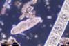 960px-Paramecium_caudatum_(248_06)_Native_preparation