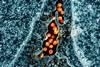 HIV_Virus_Particles_-_2 (1)
