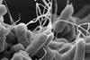 E-coli_(Escherichia_coli)