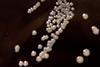 Bordetella_pertussis_on_Charcoal_Agar_supplemented_with_Cephalexin_-_Detail (1)
