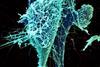 String-like_Ebola_virus_peeling_off_an_infected_cell_(20690217151)