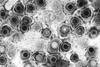 Herpes_simplex_virions,_TEM